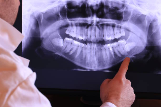 Best Emergency Treatment for Jaw Pain or Injury in Eagle Lake, TX
